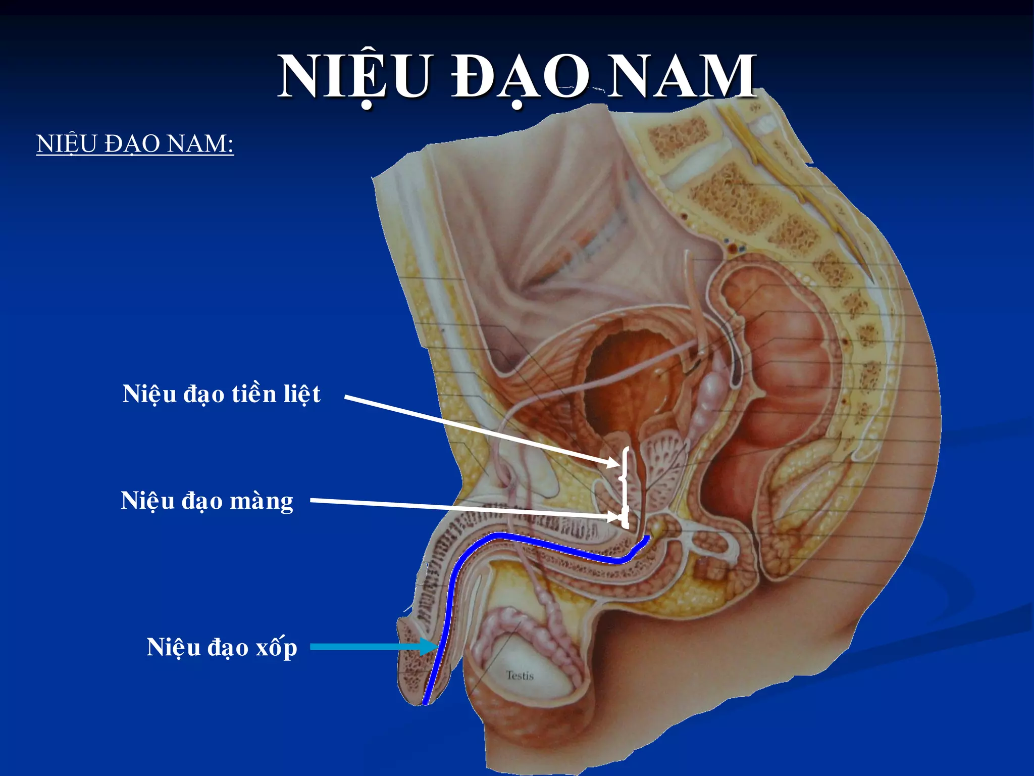 NIỆU ĐẠO NAM:
Nieäu ñaïo tieàn lieät
Nieäu ñaïo maøng
Nieäu ñaïo xoáp
NIỆU ĐẠO NAM
 