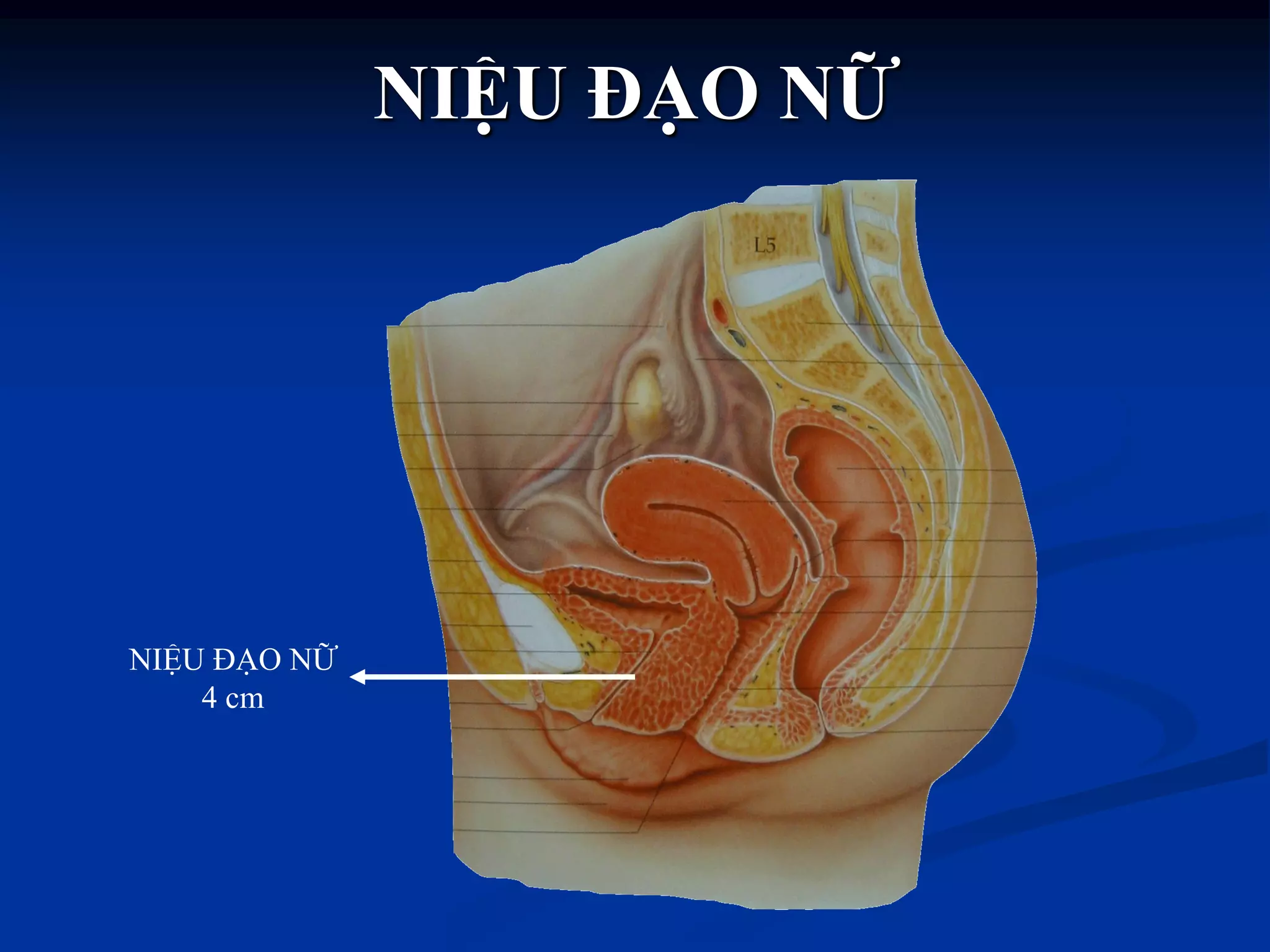 NIỆU ĐẠO NỮ
4 cm
NIỆU ĐẠO NỮ
 
