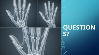 X Ray Module Question Introduction_To_Basic_X-ray_Module 1.pptx