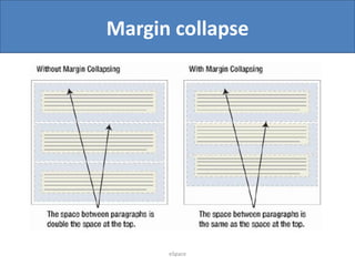 Margin collapse

eSpace

 