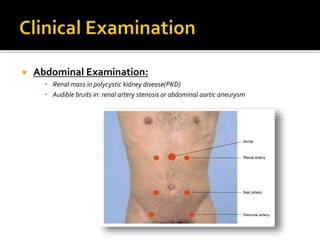  Abdominal Examination:
• Renal mass in polycystic kidney disease(PKD)
• Audible bruits in: renal artery stenosis or abdominal aortic aneurysm
 