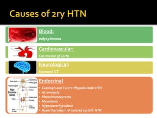 Blood:
polycythemia
Cardiovascular:
Coarctation of aorta
Neurological:
Increased ICT
Endocrinal
• Cushing’s and Conn’shypokalemic HTN
• Acromegaly
• Pheochromocytoma
• Myxedema
• Hyperparathyroidism
• Hyperthyroidism isolated systolic HTN
• Congenital adrenal hyperplasia
 