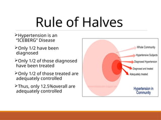 Rule of Halves
Hypertension is an
“ICEBERG” Disease
Only 1/2 have been
diagnosed
Only 1/2 of those diagnosed
have been treated
Only 1/2 of those treated are
adequately controlled
Thus, only 12.5%overall are
adequately controlled
 