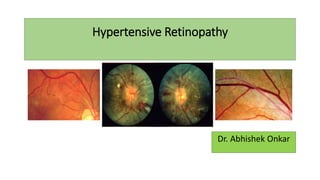 Hypertensive Retinopathy
Dr. Abhishek Onkar
 