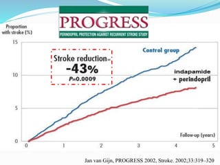 Jan van Gijn, PROGRESS 2002, Stroke. 2002;33:319–320
 