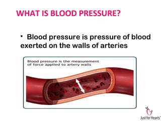WHAT IS BLOOD PRESSURE?
 Blood pressure is pressure of blood
exerted on the walls of arteries
 