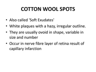 COTTON WOOL SPOTS
• Also called 'Soft Exudates'
• White plaques with a hazy, irregular outline.
• They are usually ovoid in shape, variable in
size and number
• Occur in nerve fibre layer of retina result of
capillary infarction
 