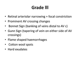 Grade lll
• Retinal arteriolar narrowing + focal constriction
• Prominent AV crossing changes
• Bonnet Sign (banking of veins distal to AV c)
• Gunn Sign (tapering of vein on either side of AV
crossings)
• Flame shaped haemorrhages
• Cotton wool spots
• Hard exudates
 