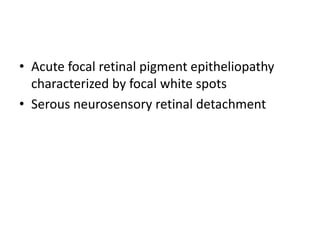 • Acute focal retinal pigment epitheliopathy
characterized by focal white spots
• Serous neurosensory retinal detachment
 