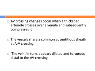 AV crossing changes occur when a thickened
arteriole crosses over a venule and subsequently
compresses it
 The vessels share a common adventitious sheath
at A-V crossing
 The vein, in turn, appears dilated and torturous
distal to the AV crossing.
 