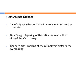  AV Crossing Changes
1. Salus’s sign: Deflection of retinal vein as it crosses the
arteriole.
2. Gunn’s sign: Tapering of the retinal vein on either
side of the AV crossing.
3. Bonnet’s sign: Banking of the retinal vein distal to the
AV crossing.
 