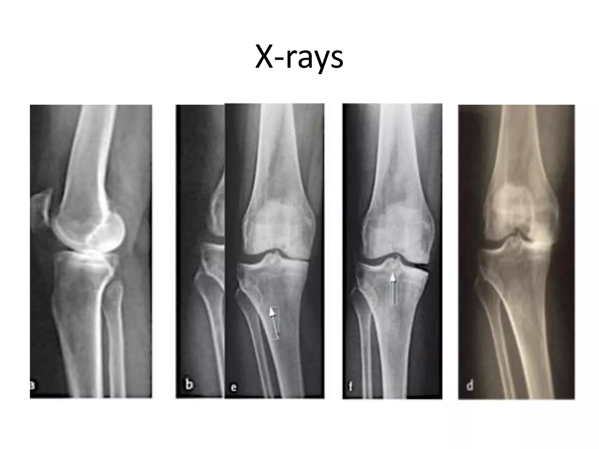 X-rays
 