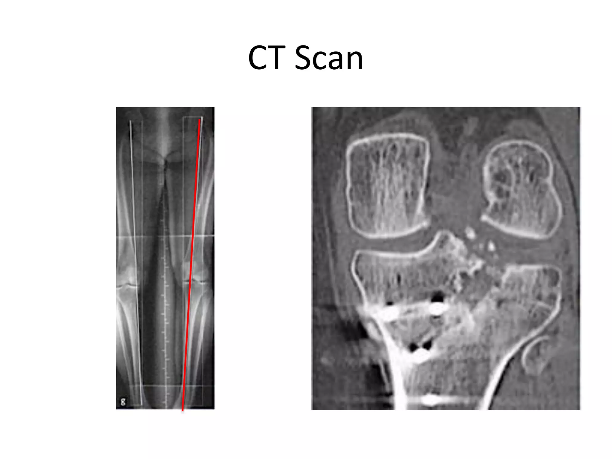 CT Scan
 