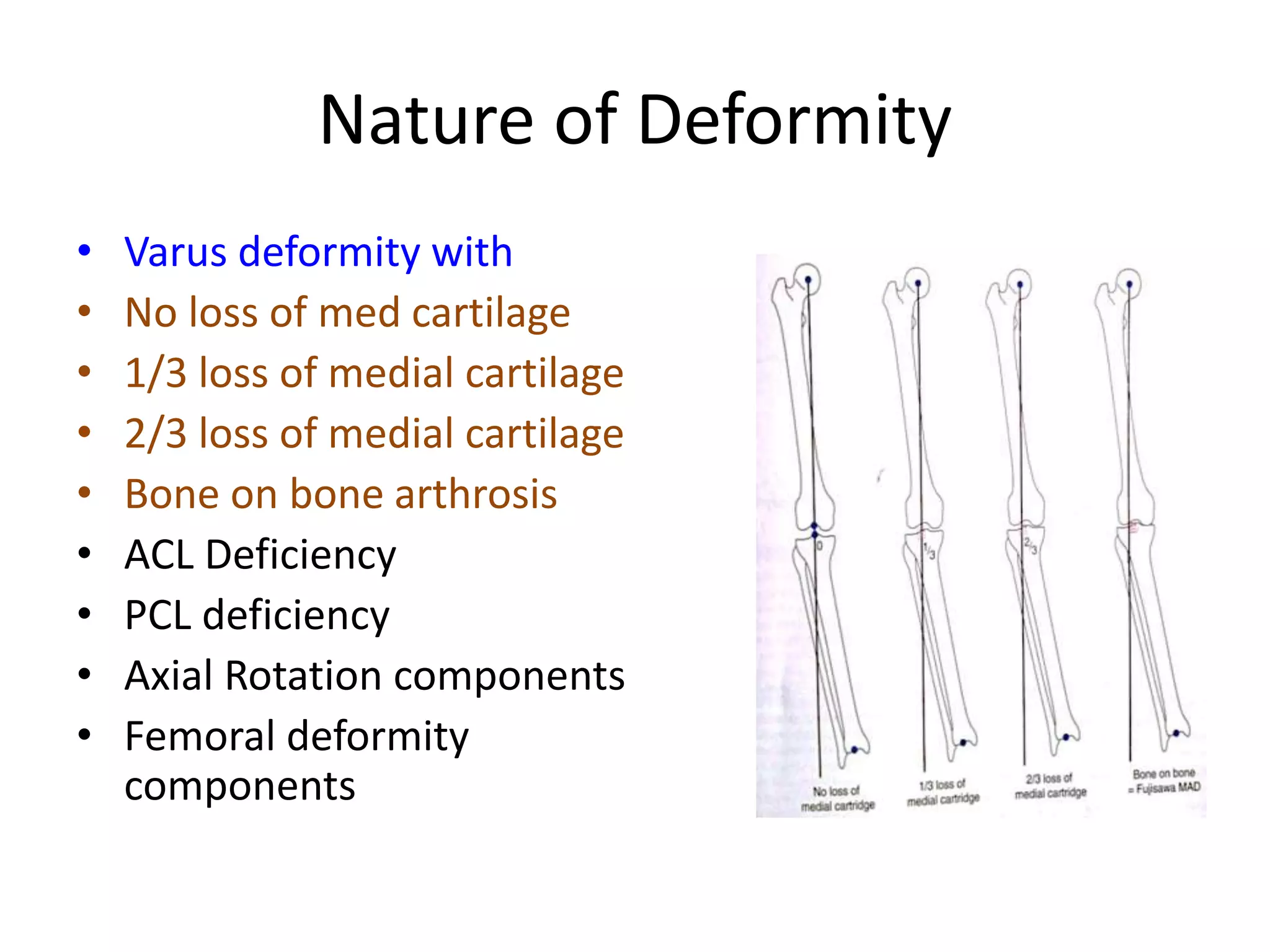 Nature of Deformity
• Varus deformity with
• No loss of med cartilage
• 1/3 loss of medial cartilage
• 2/3 loss of medial cartilage
• Bone on bone arthrosis
• ACL Deficiency
• PCL deficiency
• Axial Rotation components
• Femoral deformity
components
 