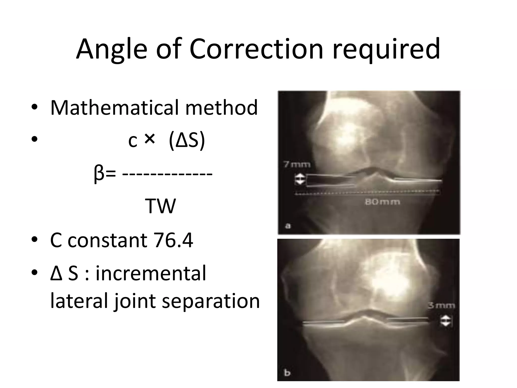 Angle of Correction required
• Mathematical method
• c × (ΔS)
β= -------------
TW
• C constant 76.4
• ∆ S : incremental
lateral joint separation
 