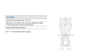 Alignment Tibia Acceptability High tibial osteotoy and alignment view of the knee | PPTX