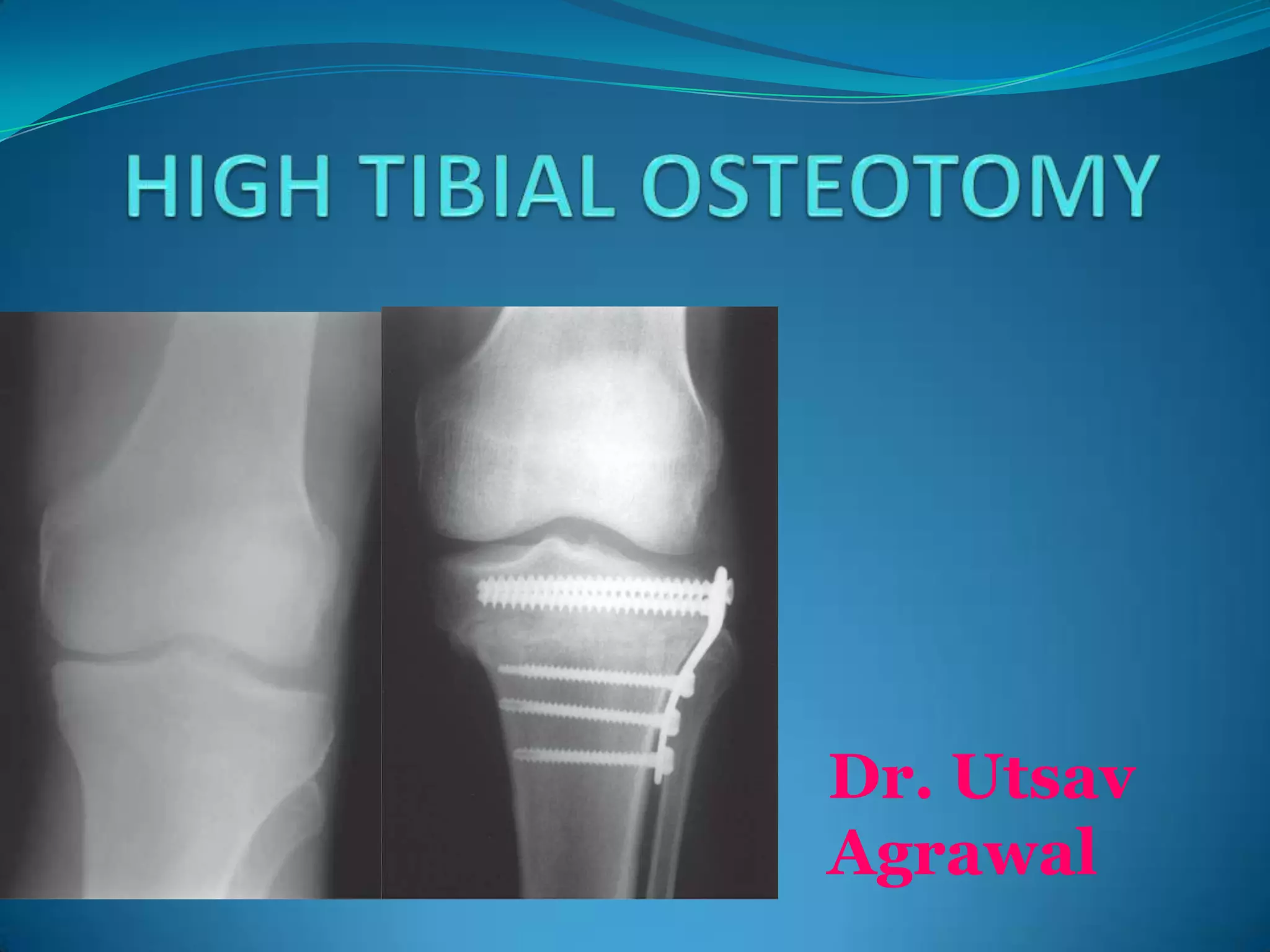 Dr. Utsav
Agrawal
 
