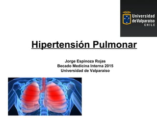 Hipertensión Pulmonar
Jorge Espinoza Rojas
Becado Medicina Interna 2015
Universidad de Valparaíso
 