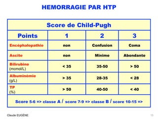 HEMORRAGIE PAR HTP
13Claude EUGÈNE
Score de Child-Pugh
Points 1 2 3
Encéphalopathie non Confusion Coma
Ascite non Minime A...