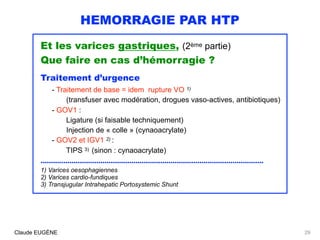HEMORRAGIE PAR HTP
Et les varices gastriques, (2ème partie)
Que faire en cas d’hémorragie ?
Traitement d’urgence
- Traitem...