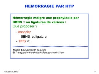 HEMORRAGIE PAR HTP
Hémorragie malgré une prophylaxie par
BBNS 1) ou ligatures de varices :  
Que proposer ?
- Associer 
BB...