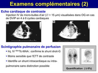 Examens complémentaires (2)
Echo cardiaque de contraste
   Injection IV de micro-bulles d’air ( > 15 µm) visualisées dans OG en cas
   de DVIP en 4 à 6 cycles cardiaques




Scintigraphie pulmonaire de perfusion
    Inj. IV 99mTc-MAA : confirme le shunt droit-G
    Moins sensible que l’ETT de contraste
    Identifie un shunt intracardiaque ou intra-
   pulmonaire sans distinction possible
                                                     Quantification ( ≥ 6%)
 