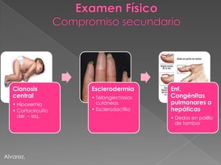 Cianosis          Esclerodermia       Enf.
   central           • Telangiectasias   Congénitas
   • Hipoxemia         cutáneas          pulmonares o
   • Cortocircuito   • Esclerodactilia   hepáticas
     der. – Izq.                         • Dedos en palillo
                                           de tambor




Alvarez,
 