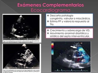  Descarta patología
  congénita, valvular o miocárdica.
 Estima PP y valora la respuesta al
  Tto.

 Crecimiento y sobrecarga de VD.
 Movimiento anormal diastólico y
  sistólico del septo interventricular.
 