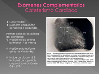  Confirma HTP
 Descarta cardiopatía
  congénita o adquirida

Permite conocer severidad
del pronóstico:
 Presión media arterial
  pulmonar > 55 mmHg

 Presión en la aurícula
  derecha >10 mmHg

 Índice cardíaco < 2,5
  l/min/m2 de superficie
  corporal saturación de
  O2 < 63%
 