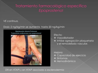 VE continua.

Dosis: 2 ng/kg/min se aumenta hasta 20 ng/kg/min


                                        Efecto:
                                         Vasodilatador
                                         Inhibe agregación plaquetaria
                                           y el remodelado vascular.


                                        Mejora:
                                         Capacidad de ejercicio
                                         Síntomas
                                         Hemodinámica


 Útil en HTAPI y en HTAP asociada a esclerodermia
 