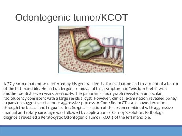 Un enfoque científico del tratamiento de los cordales 