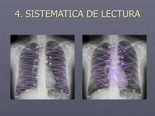 4. SISTEMATICA DE LECTURA
 