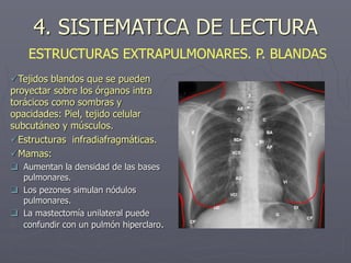 Tejidos blandos que se pueden
proyectar sobre los órganos intra
torácicos como sombras y
opacidades: Piel, tejido celular
subcutáneo y músculos.
Estructuras infradiafragmáticas.
Mamas:
 Aumentan la densidad de las bases
pulmonares.
 Los pezones simulan nódulos
pulmonares.
 La mastectomía unilateral puede
confundir con un pulmón hiperclaro.
4. SISTEMATICA DE LECTURA
ESTRUCTURAS EXTRAPULMONARES. P. BLANDAS
 