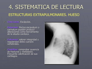 4. SISTEMATICA DE LECTURA
ESTRUCTURAS EXTRAPULMONARES. HUESO
 Clavículas. Escápulas.
 Esternón: Pectus excavatum o
carinatum pueden producir
alteraciones como borramiento
de la silueta cardiaca.
 Columna: valorar integridad y
regularidad delos cuerpos
vertebrales.
 Costillas: comprobar ausencia
de fracturas y metástasis.
Frecuente calcificación de sus
cartílagos.
 