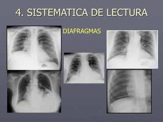 4. SISTEMATICA DE LECTURA
DIAFRAGMAS
 