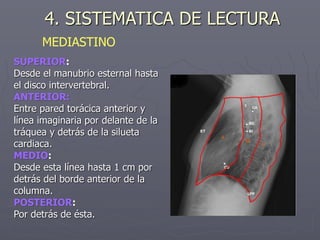 SUPERIOR:
Desde el manubrio esternal hasta
el disco intervertebral.
ANTERIOR:
Entre pared torácica anterior y
línea imaginaria por delante de la
tráquea y detrás de la silueta
cardiaca.
MEDIO:
Desde esta línea hasta 1 cm por
detrás del borde anterior de la
columna.
POSTERIOR:
Por detrás de ésta.
4. SISTEMATICA DE LECTURA
MEDIASTINO
 