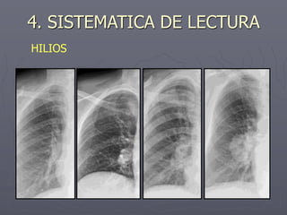 4. SISTEMATICA DE LECTURA
HILIOS
 