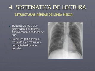 4. SISTEMATICA DE LECTURA
 Tráquea: Central, algo
desplazada a la derecha.
Ángulo carinal alrededor de
60º.
 Bronquios principales: El
izquierdo algo más alto y
horizontalizado que el
derecho.
ESTRUCTURAS AÉREAS DE LÍNEA MEDIA:
 