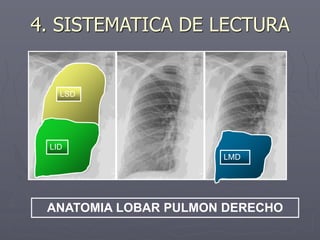 LSD
LID
LMD
ANATOMIA LOBAR PULMON DERECHO
4. SISTEMATICA DE LECTURA
 