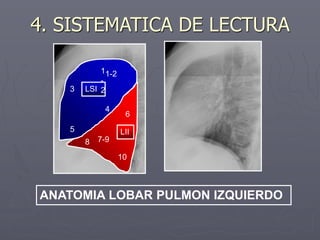 ANATOMIA LOBAR PULMON IZQUIERDO
LII
LSI
1
-
2
1-2
3
4
5
6
10
8 7-9
4. SISTEMATICA DE LECTURA
 