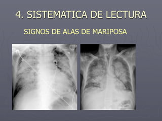 4. SISTEMATICA DE LECTURA
SIGNOS DE ALAS DE MARIPOSA
 