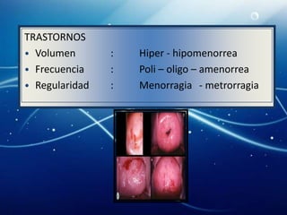 TRASTORNOS
• Volumen       :   Hiper - hipomenorrea
• Frecuencia    :   Poli – oligo – amenorrea
• Regularidad   :   Menorragia - metrorragia
 