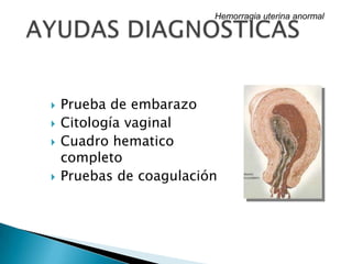  Prueba de embarazo
 Citología vaginal
 Cuadro hematico
completo
 Pruebas de coagulación
Hemorragia uterina anormal
 