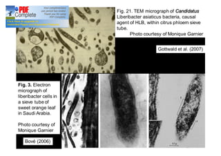 Fig. 21. TEM micrograph of Candidatus 
Liberibacter asiaticus bacteria, causal 
agent of HLB, within citrus phloem sieve 
tube. 
Photo courtesy of Monique Garnier 
Gottwald et al. (2007) 
Fig. 3. Electron 
micrograph of 
liberibacter cells in 
a sieve tube of 
sweet orange leaf 
in Saudi Arabia. 
Photo courtesy of 
Monique Garnier 
Bové (2006) 
 