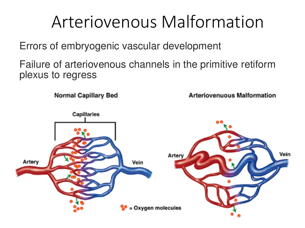 Topic vascular anomalies