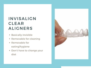 All About Invisalign - What You Need to Know | PDF