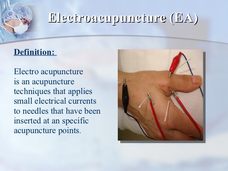 Electro Acupuncture
