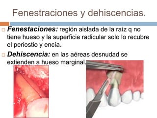 Fenestraciones y dehiscencias.Fenestaciones: región aislada de la raíz q no tiene hueso y la superficie radicular solo lo recubre el periostio y encía.Dehiscencia: en las aéreas desnudad se extienden a hueso marginal.