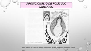 APOSICIONAL O DE FOLÍCULO
DENTARIO
Nanci, Antonio. Ten Cate’s Oral Histology : Development, Structure, and Function. Philadelphia, Elsevier,
2017.
 