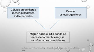 Células progenitoras
mesenquimatosas
indiferenciadas
Células
osteoprogenitoras
Migran hacia el sitio donde se
necesite formar hueso y se
transforman es osteoblastos
Lindhe, Jan. Lindhe’s Clinical Periodontology and Implant Dentistry 7e. Editorial médica Panamerica S.A.C.F,
2017.
 
